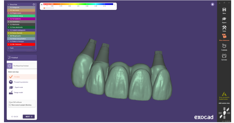 천호동 임플란트 앞니가 왜 어렵다는거죠? 수술이 안된다는데... 관련 이미지 2
