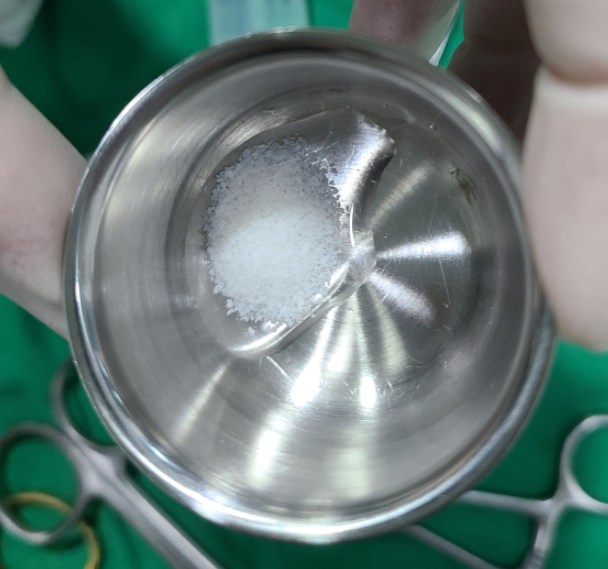 강동구 뼈이식 임플란트 과잉이라 생각하실 수 있지만 진실은 관련 이미지 1