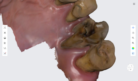 네비게이션 임플란트가 왜 좋다고 그러는거죠? (feat.13가지 장점) 관련 이미지 9