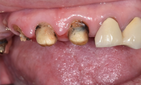 합죽이입 처럼 보이는 이유, 낮아진 관련 이미지 9