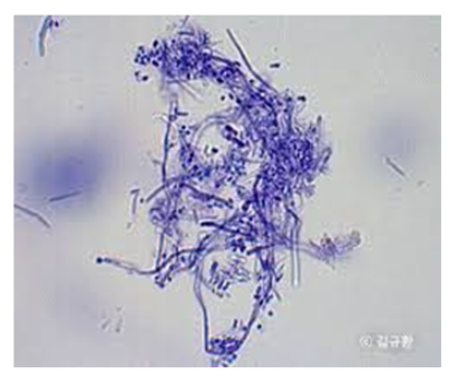 강동구 치과 충치는 전염될까?? 다른 치아로 옮겨갈까? 관련 이미지 1