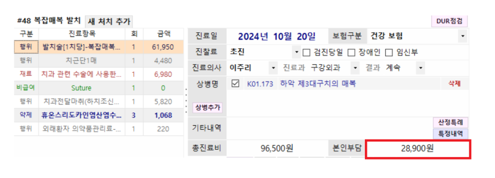 상일동 치과 매복 사랑니 발치 비용 정리해보았습니다!! 관련 이미지 8