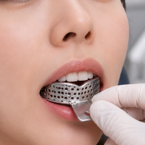 “Taking Impressions” Is Disappearing: What’s Different About Digital Impressions with an Intraoral Scanner? image 1