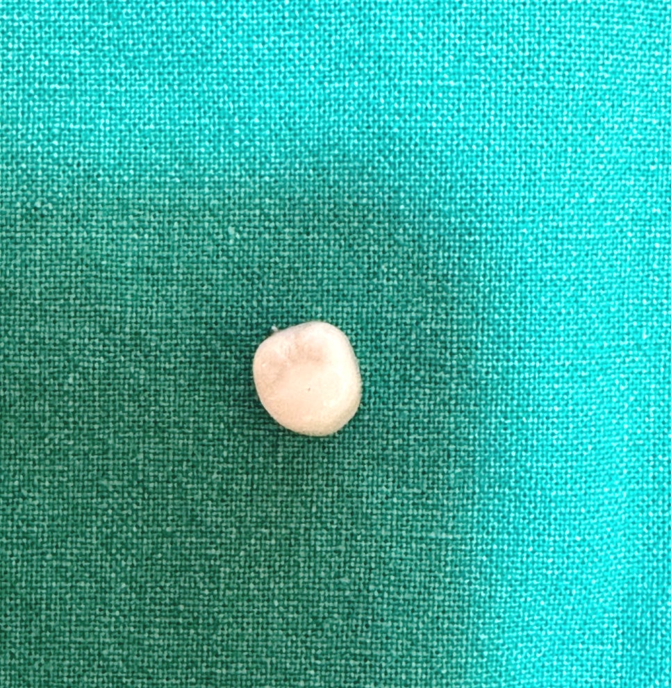 천호동 치과 임플란트 크라운 종류 설명 나갑니다. 관련 이미지 4