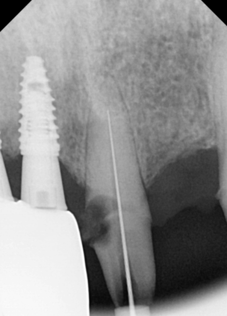 음식물 끼임, 거뭇한 무언가 보인다면? 이미 늦었을 수 있습니다. 관련 이미지 10