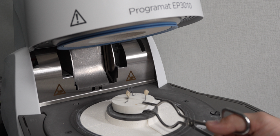 보철치료 하루만에 편하고 빠르게 시간이 없을 때는? 관련 이미지 4