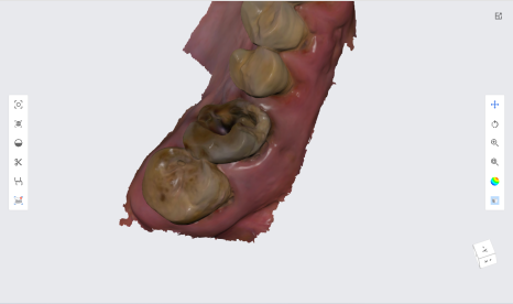 네비게이션 임플란트가 왜 좋다고 그러는거죠? (feat.13가지 장점) 관련 이미지 8