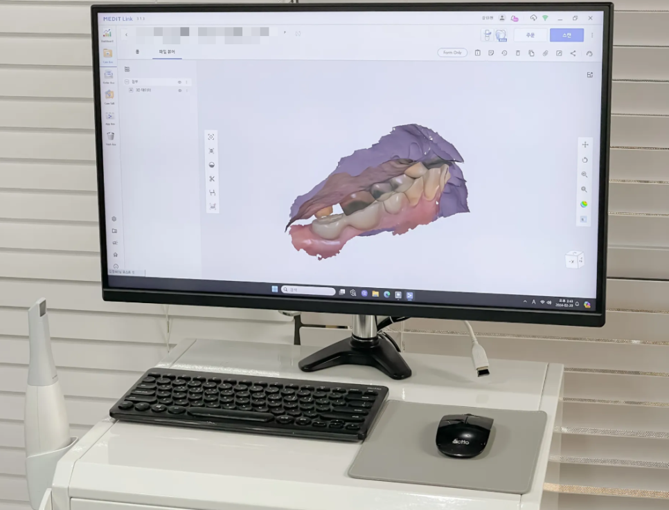 천호동 치아교정 음식 어떤걸 먹고 피해야하는지 팩트 알려드립니다. 관련 이미지 4