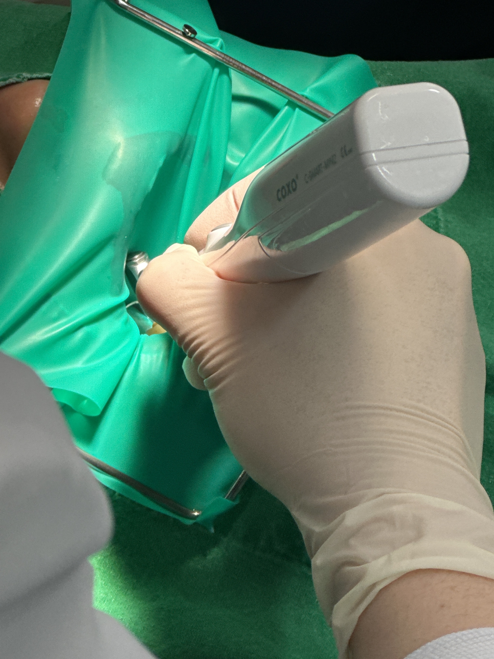 상일동 신경치료 러버댐이 무엇인지 궁금하신가요? 관련 이미지 5