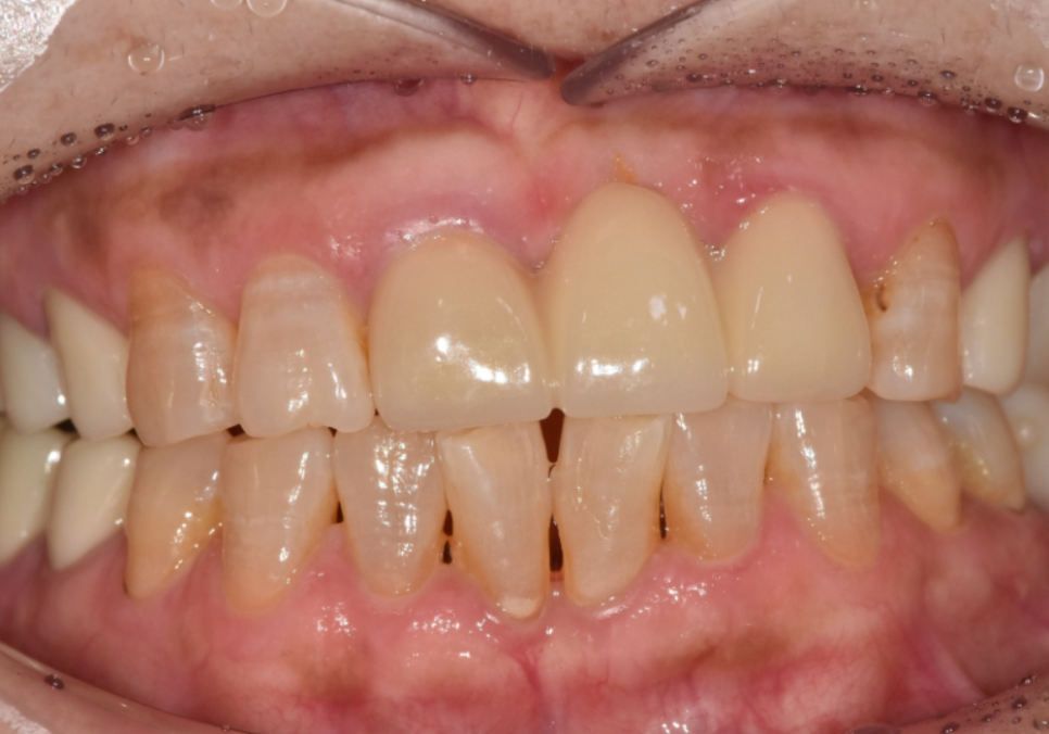 삐딱하게 뻗은 관련 이미지 5