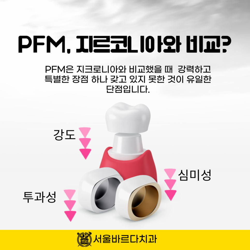 상일동치과 서울바르다치과, 다 똑같은 크라운인지 알았는데 지르코니아와 PFM의 차이를 알고계신가요~? 관련 이미지 6