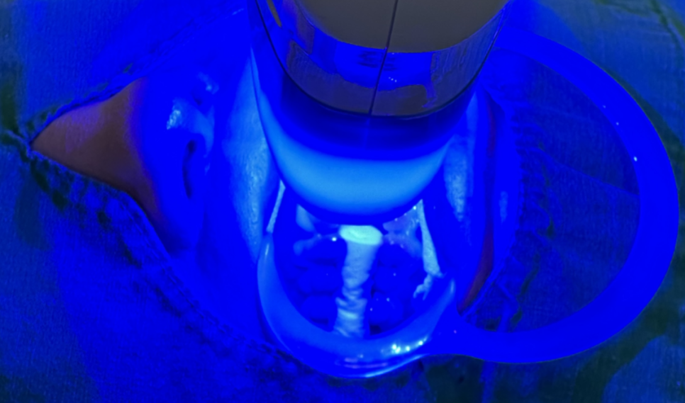 치아미백치료 연예인 같은 치아 나도 될 수 있을까? 팩폭해드릴께요 관련 이미지 5