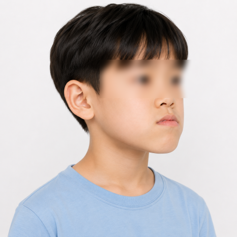 우리 아이 주걱턱, "크면서 괜찮아지겠지"가 위험한 이유 관련 이미지 4