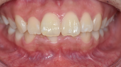 강동구 교정치과 교정 진단비와 관련된 공지 관련 이미지 8