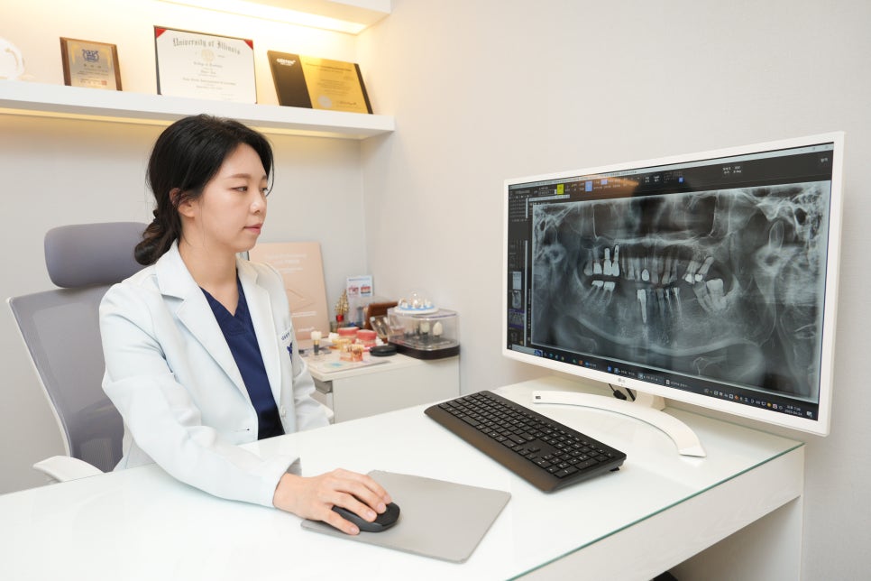 이 뽑고 바로 임플란트 심어도 될까요?? 관련 이미지 2