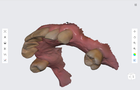 네비게이션 임플란트가 왜 좋다고 그러는거죠? (feat.13가지 장점) 관련 이미지 2