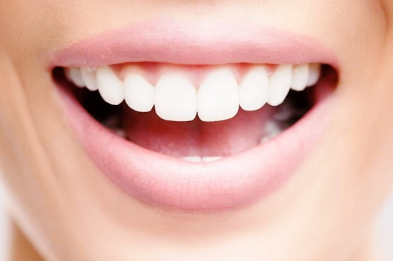 치아성형과 심미 치과 | 자신감 있는 미소를 만드는 방법 관련 이미지 1