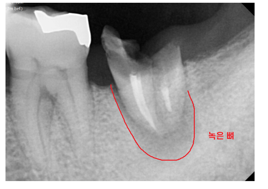 하남 미사 치과 공포증 치료가 두려우신 분들 컴온 관련 이미지 4