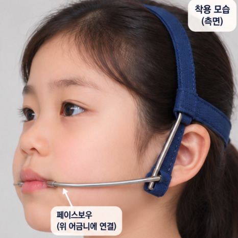 상일동 어린이 교정 시기, 만 7세를 놓치지 마세요 관련 이미지 9
