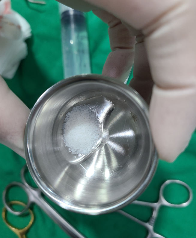 고덕동 치과 임플란트 뼈이식 꼭 해야하는건가요? 관련 이미지 2