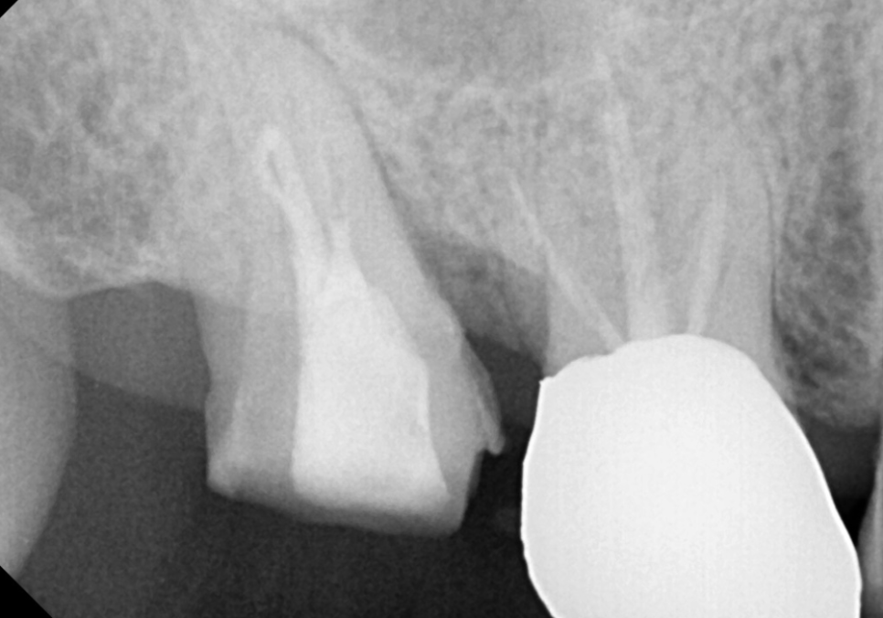 시큰거리는 통증, 시린 이 치약으로 해결 안 된다고요? 관련 이미지 10