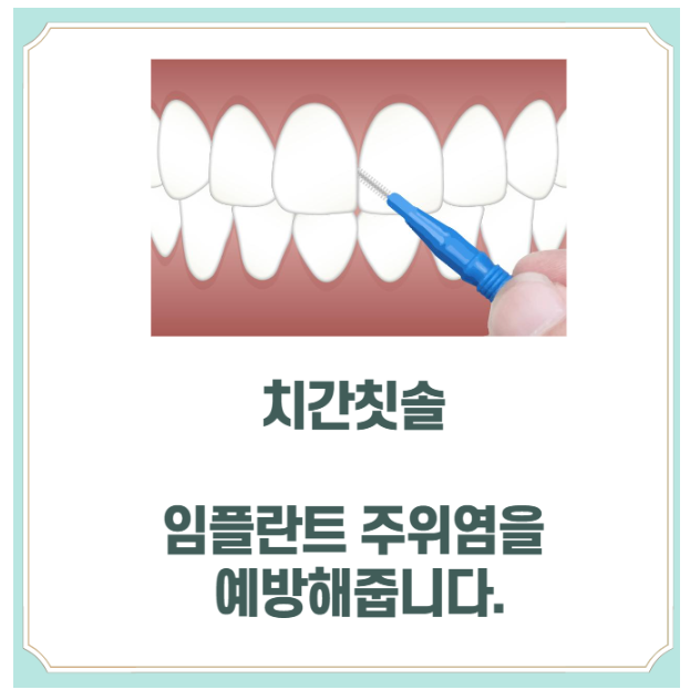 임플란트 수명 유지 관리 방법 도대체 어떻게 해야하나요? 관련 이미지 5
