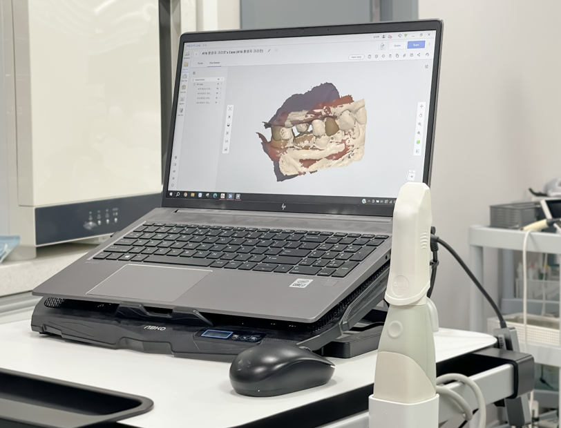 디지털 임플란트 체계적인 수술이 가능한 서울바르디치과입니다. 관련 이미지 3