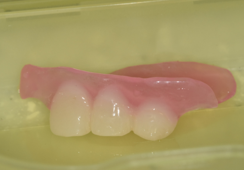 오래된 앞니 크라운 냄새, 관련 이미지 8