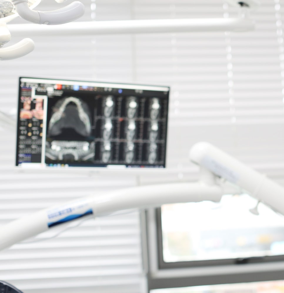 하남 치과 임플란트 질문 폭격기를 환영합니다. 결정은 자유롭게! 관련 이미지 4