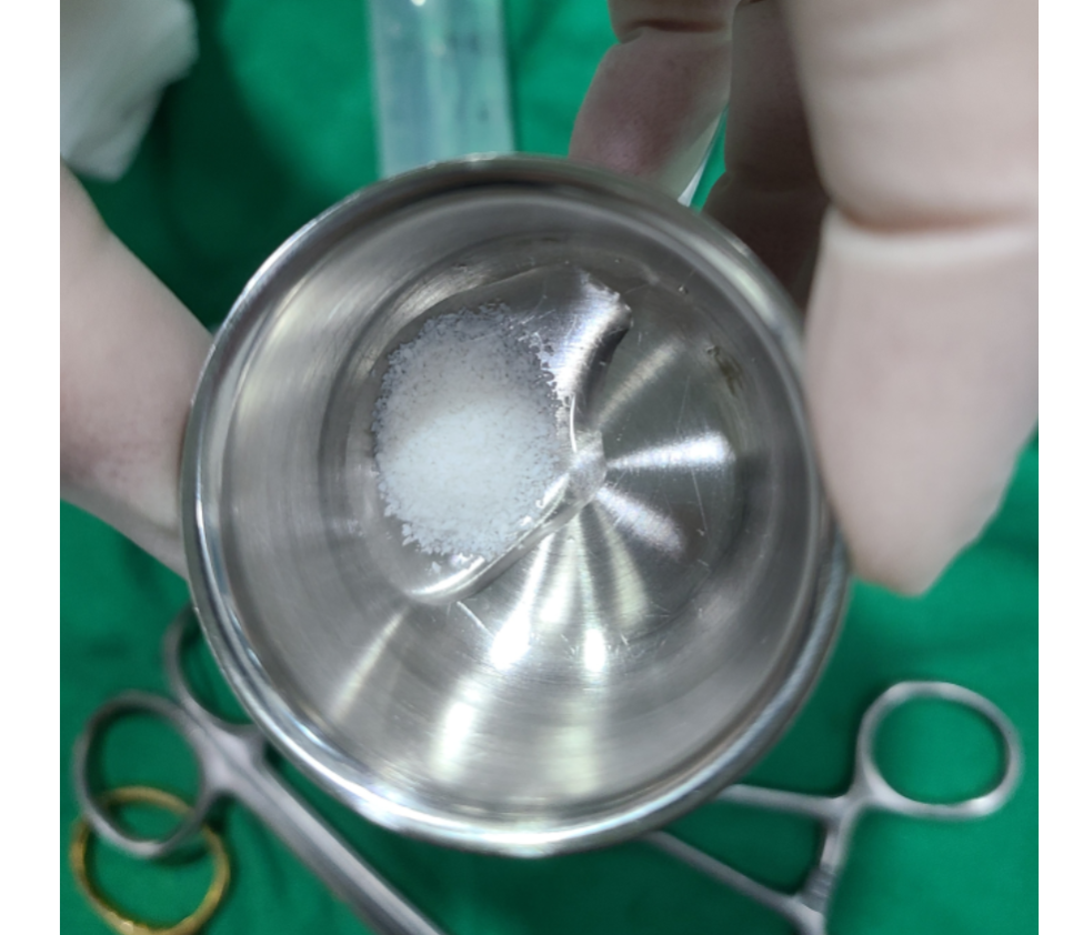Is It Difficult to Shorten the Implant Procedure Period? Why It Differs from Person to Person image 7