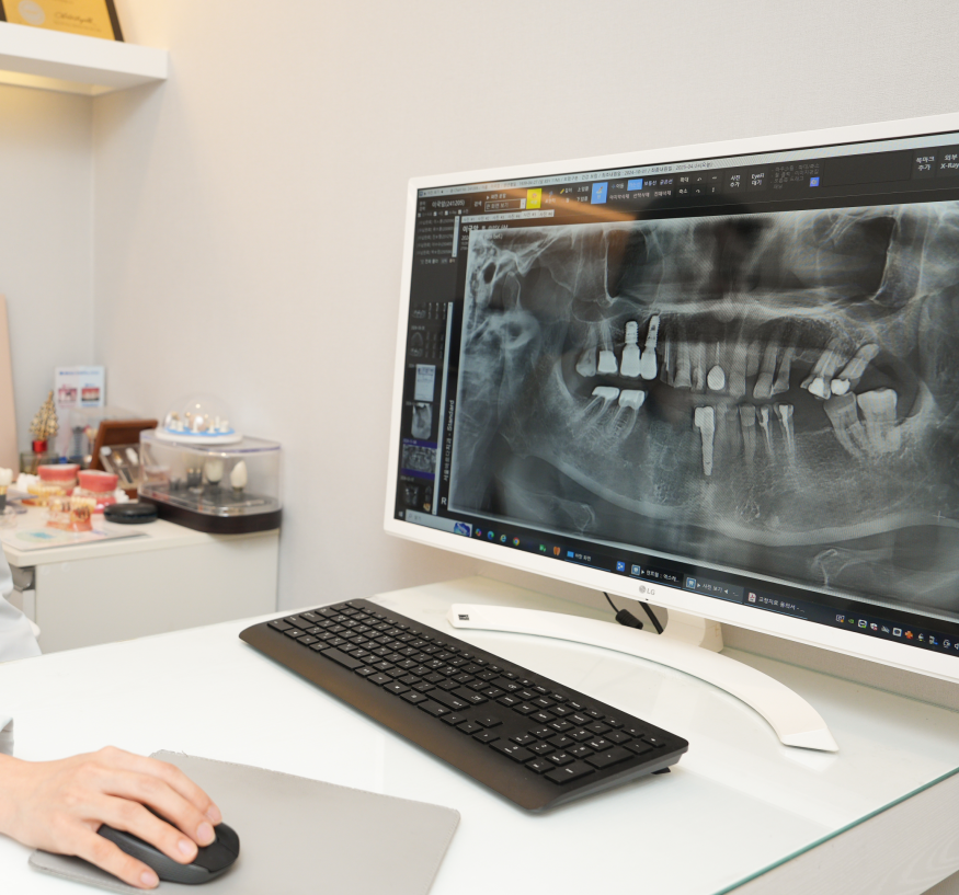 치아 교정 스프링 공간을 확보하기 위한 오픈코일 알아봐요 관련 이미지 4