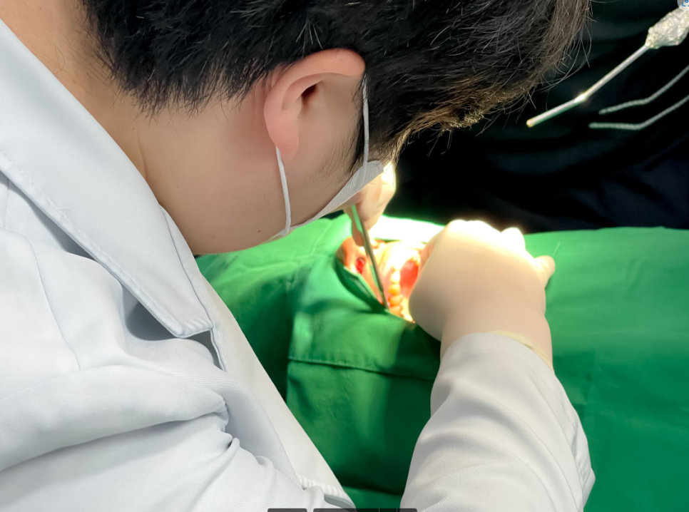 둔촌동 치과 임플란트 평균 수명 이것이 진짜 진실입니다 관련 이미지 2