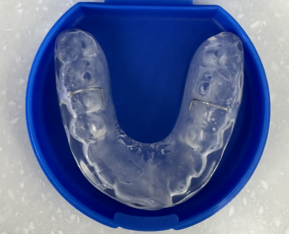 둔촌동 치과 턱 통증 귀 밑 아픔 턱관절 장애를 의심하세요!! 관련 이미지 5