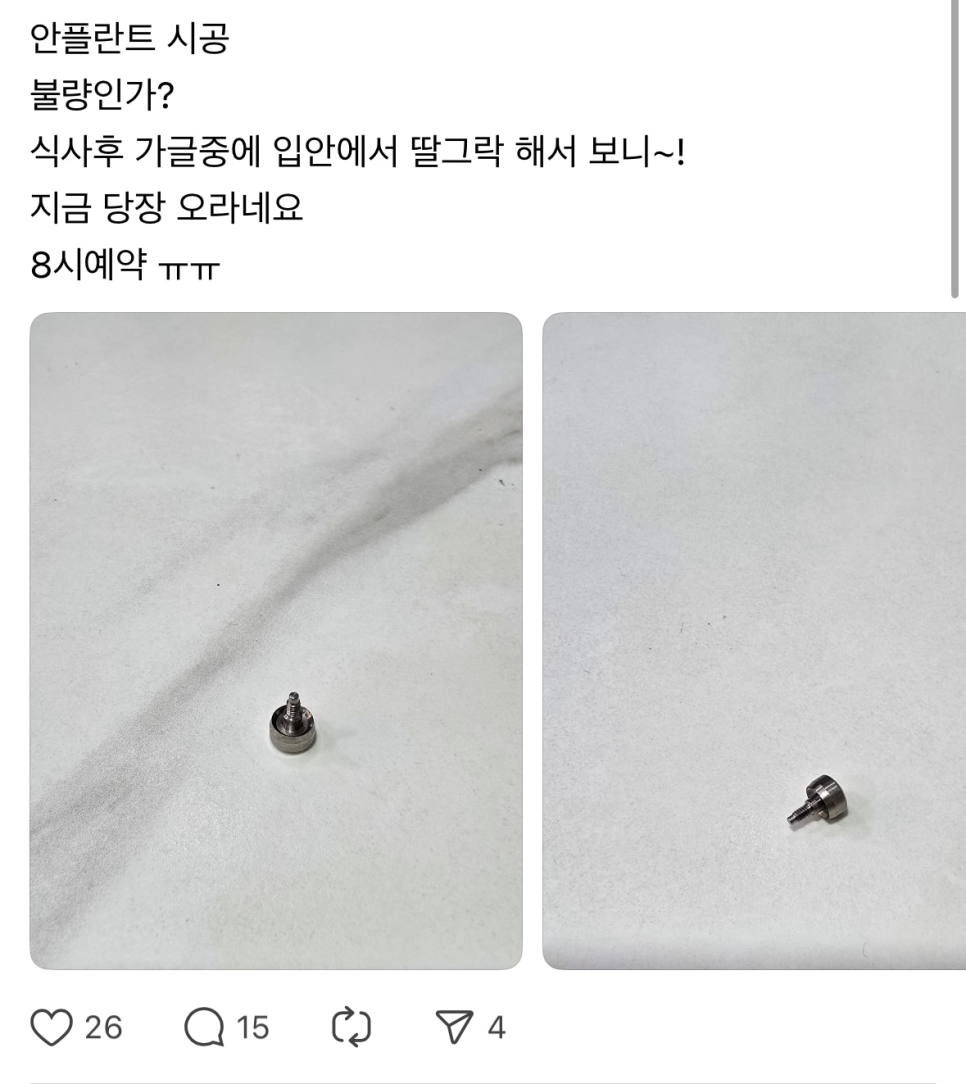 임플란트 뚜껑 빠짐 시공이 잘못된거 아냐? 생각이 들으셨다면 관련 이미지 2