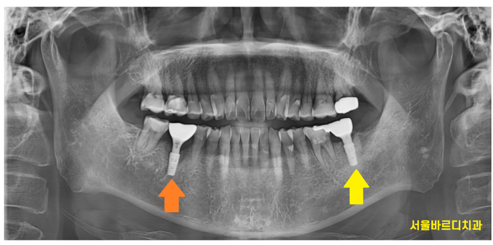 하남 미사 치과 공포증 치료가 두려우신 분들 컴온 관련 이미지 10