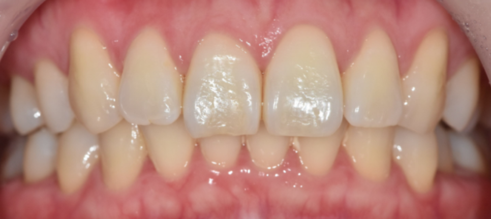 강동 치과 과잉 진료를 피하려면 이것을 확인하세요!! 관련 이미지 6