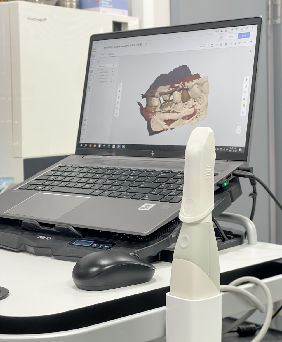 상일동역 임플란트 구강스캐너로 디지털 진료 선두하는 대표 치과입니다! 관련 이미지 10