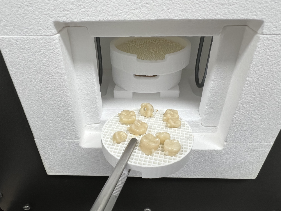 네비게이션 임플란트가 왜 좋다고 그러는거죠? (feat.13가지 장점) 관련 이미지 23