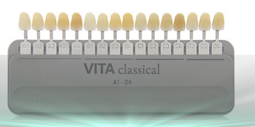 명일동 치과, 미백하면 연예인 치아처럼 새하얘진다는 말, 저는 못하겠습니다. 관련 이미지 8