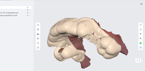네비게이션 임플란트가 왜 좋다고 그러는거죠? (feat.13가지 장점) 관련 이미지 4