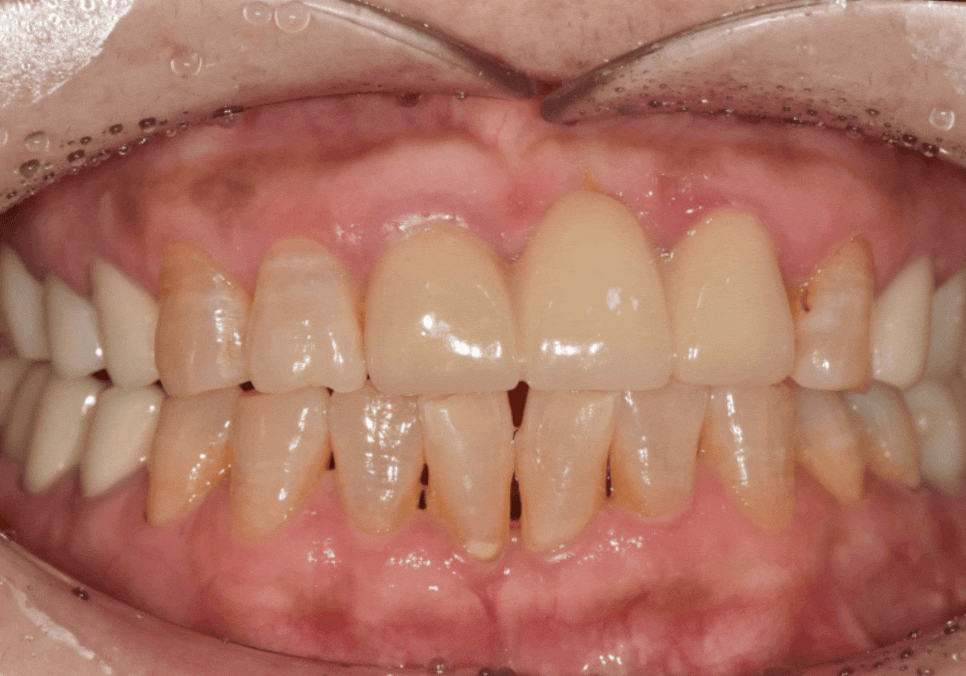 삐딱하게 뻗은 관련 이미지 10