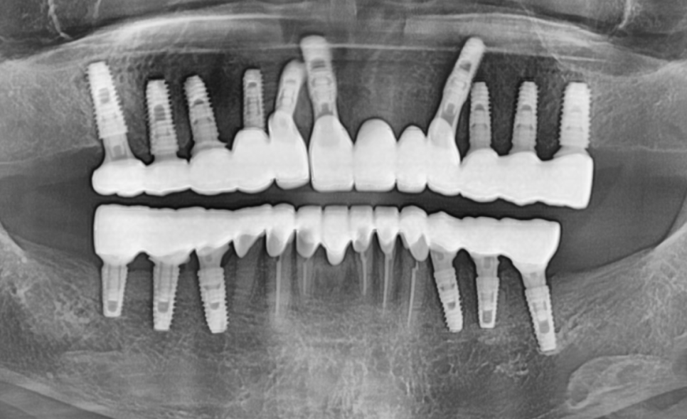 합죽이입 처럼 보이는 이유, 낮아진 관련 이미지 11