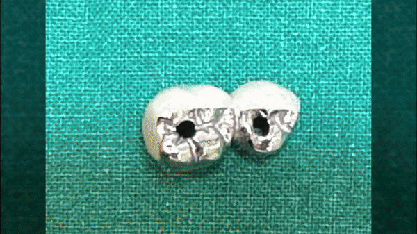 상일동 치과 임플란트 국가 지원 혜택 싹 정리했습니다. 관련 이미지 1