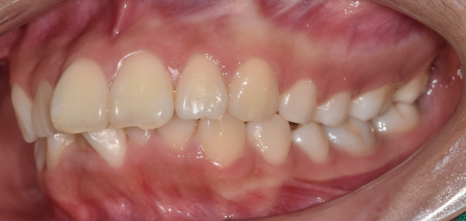 강동구 교정치과 교정 진단비와 관련된 공지 관련 이미지 9