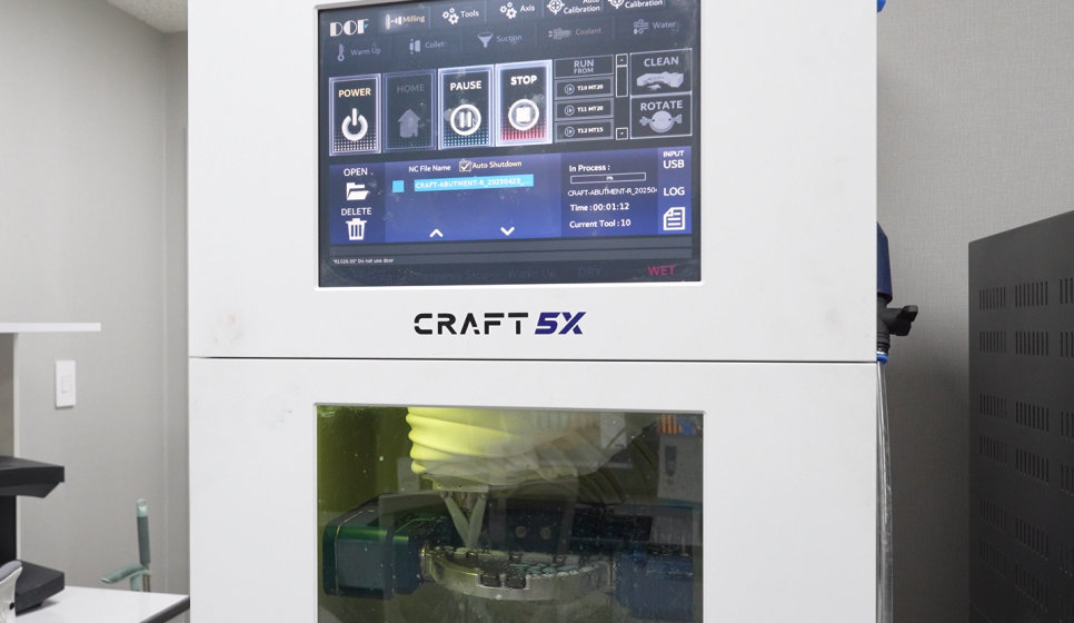 하루만에 임플란트 당일치기가 가능한 조건은?? 관련 이미지 3