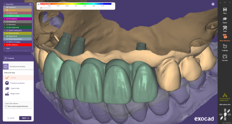 네비게이션 임플란트가 왜 좋다고 그러는거죠? (feat.13가지 장점) 관련 이미지 19