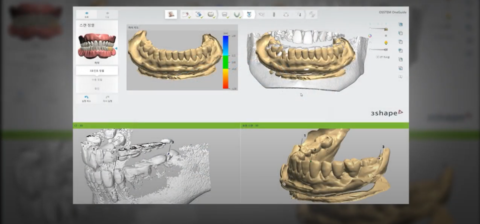 상일동역 치과 서울바르다치과 지금 시작합니다 관련 이미지 4