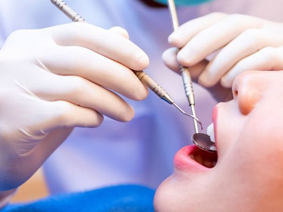 치주질환의 진행 속도: 방치하면 어떻게 될까? 관련 이미지 1