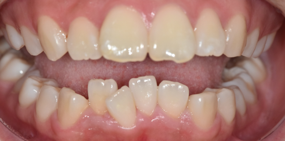 강동구 교정치과 교정 진단비와 관련된 공지 관련 이미지 10