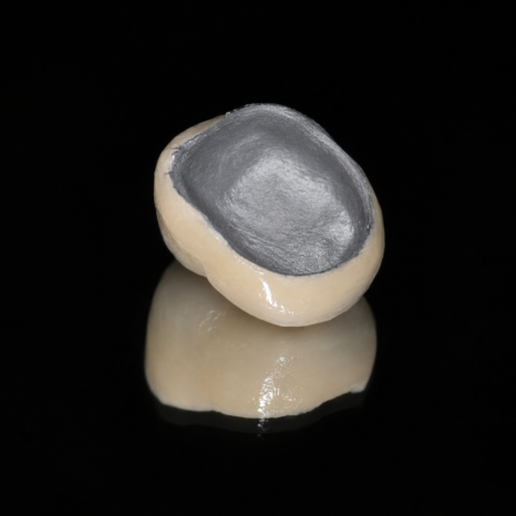 Tooth-Colored Dental Crown Types: PFM and Zirconia (Ziconia) image 2